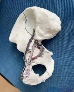 yyi3dprint home industries (11)